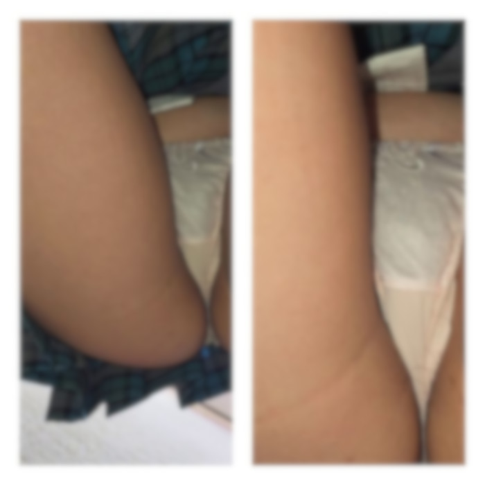 スカート短すぎギャルJKの肉感ムチムチお尻を堪能 ねんいち65-006